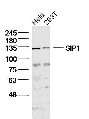Anti-SIP1 antibody (bs-20485R) - 信裕生物官方网站-信裕生物-试剂盒 