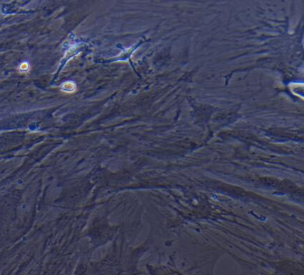 image 2021101305032220140